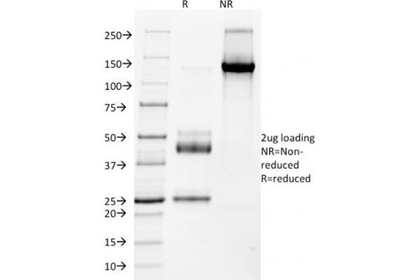 Nkx2-2 抗体  (AA 1-119)