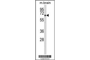 Western Blotting (WB) image for anti-Disabled Homolog 1 (Drosophila) (DAB1) antibody (ABIN2158479)