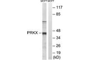 Image no. 1 for anti-Protein Kinase, X-Linked (PRKX) (AA 251-300) antibody (ABIN1535340)