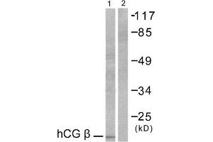 Image no. 1 for anti-HCG beta (C-Term) antibody (ABIN1848592)