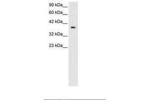 Image no. 1 for anti-5'-Nucleotidase, Cytosolic III (NT5C3) (AA 185-234) antibody (ABIN6735799)