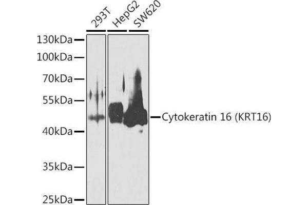 KRT16 抗体  (AA 190-430)