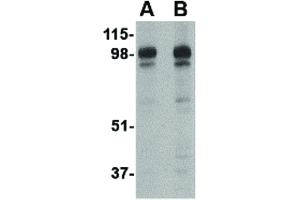 Image no. 3 for anti-SLIT and NTRK-Like Family, Member 2 (SLITRK2) (C-Term) antibody (ABIN6656784)