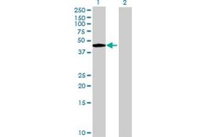 anti-Exonuclease 3'-5' Domain Containing 1 (EXD1) (AA 1-514) antibody