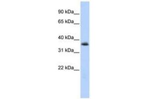 Image no. 1 for anti-Motor Neuron and Pancreas Homeobox 1 (MNX1) (AA 36-85) antibody (ABIN6740279)
