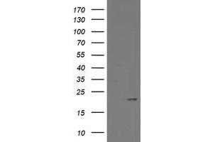 Image no. 9 for anti-ADP-Ribosylation Factor-Like 2 Binding Protein (ARL2BP) antibody (ABIN1496715)