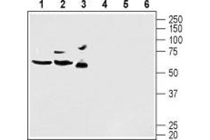KCND2 antibody  (C-Term, Intracellular)