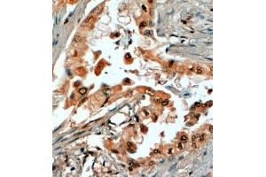 Image no. 2 for anti-Steroid-5-alpha-Reductase, alpha Polypeptide 1 (3-Oxo-5 alpha-Steroid delta 4-Dehydrogenase alpha 1) (SRD5A1) (N-Term) antibody (ABIN185346)
