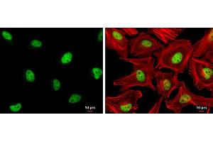 Image no. 3 for anti-Zinc Fingers and Homeoboxes 2 (ZHX2) (C-Term) antibody (ABIN2856852)