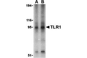 Image no. 1 for anti-Toll-Like Receptor 1 (TLR1) (Middle Region) antibody (ABIN1031127)