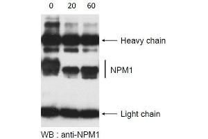 Western Blotting (WB) image for Lambda Protein Phosphatase (ABIN2451908)