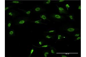 Image no. 4 for anti-Ring Finger Protein 2 (RNF2) (AA 164-223) antibody (ABIN519812)