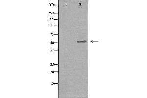 Image no. 1 for anti-Glycine Receptor, alpha 2 (GLRa2) antibody (ABIN6258919)
