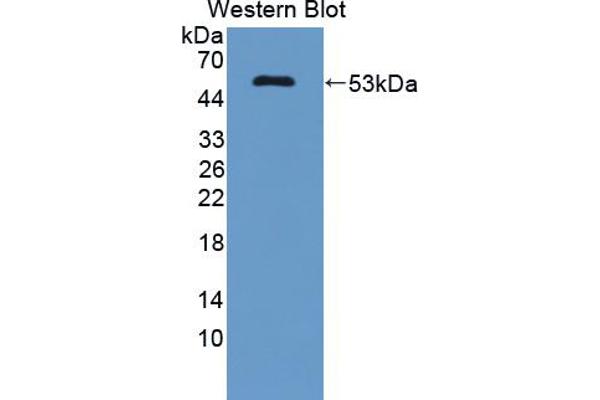 anti-Coenzyme Q10 Homolog B (COQ10B) (AA 38-238) antibody