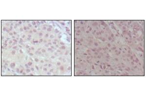 Image no. 1 for anti-Myeloid/lymphoid Or Mixed-Lineage Leukemia (MLL) (AA 3751-3968) antibody (ABIN969286)