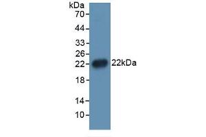 Mouse Capture antibody from the kit in WB with Positive Control: 293F transfected with IL1b gene.