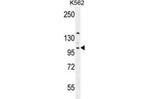 Image no. 2 for anti-Villin-Like (VILL) (AA 392-420), (Middle Region) antibody (ABIN955514)
