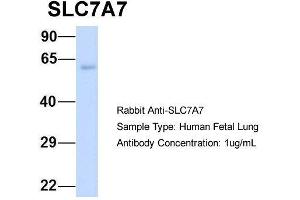 Image no. 3 for anti-Solute Carrier Family 7 (Amino Acid Transporter Light Chain, Y+L System), Member 7 (Slc7a7) (Middle Region) antibody (ABIN2781597)