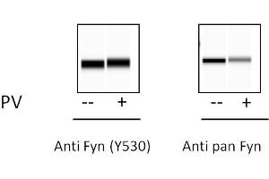 Image no. 3 for FYN Oncogene Related To SRC, FGR, YES (FYN) ELISA Kit (ABIN4889771)