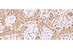 IRX1 antibody