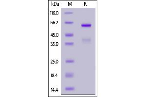 Image no. 1 for HLA-DR-gamma (CD74) (AA 73-232) protein (Fc Tag) (ABIN6992394)