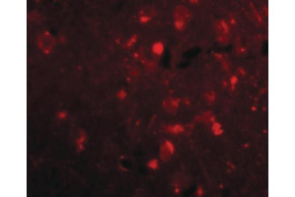 SLITRK2 anticorps  (C-Term)