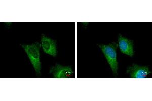 Image no. 3 for anti-Phosphogluconate Dehydrogenase (PGD) (Center) antibody (ABIN2855133)