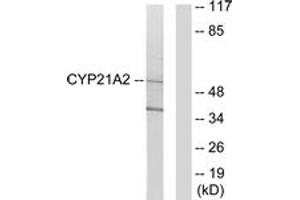 Image no. 1 for anti-Cytochrome P450, Family 21, Subfamily A, Polypeptide 2 (CYP21A2) (AA 151-200) antibody (ABIN1534376)