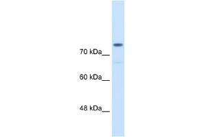 Image no. 1 for anti-Actinin, alpha 4 (ACTN4) (C-Term) antibody (ABIN2775289)
