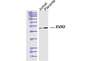 Image no. 1 for anti-Homeobox even-skipped homolog protein 2 (EVX2) (AA 1-100) antibody (ABIN5675371)