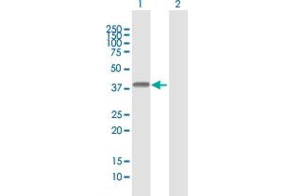 anti-HLA Class I Histocompatibility Antigen, alpha Chain E (HLA-E) (AA 1-358) antibody