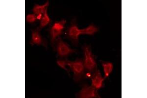 Image no. 2 for anti-Solute Carrier Family 39 (Zinc Transporter), Member 2 (Slc39a2) (N-Term) antibody (ABIN6266107)