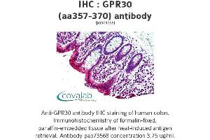 Image no. 1 for anti-G Protein-Coupled Estrogen Receptor 1 (GPER) (AA 357-370) antibody (ABIN1735055)