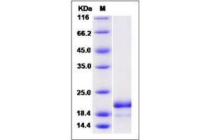 Image no. 1 for ASF1 Anti-Silencing Function 1 Homolog B (ASF1B) (AA 1-202) protein (His tag) (ABIN2006168)