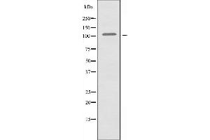 Image no. 1 for anti-Protein AF-10 (MLLT10) (Internal Region) antibody (ABIN6257326)