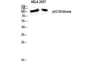 Western Blot (WB) analysis of HeLa 293T lysis using p52 S6 kinase antibody.