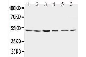 Image no. 1 for anti-Presenilin 2 (Alzheimer Disease 4) (PSEN2) (AA 39-51), (N-Term) antibody (ABIN3044383)