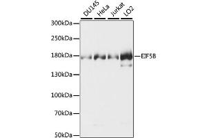 EIF5B Antikörper  (AA 1-273)