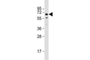 Image no. 1 for anti-Torsin A Interacting Protein 1 (TOR1AIP1) (AA 42-76) antibody (ABIN5647933)