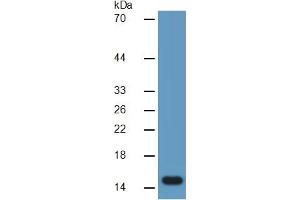 Mouse Capture antibody from the kit in WB with Positive Control: Sample Human Heart lysate.
