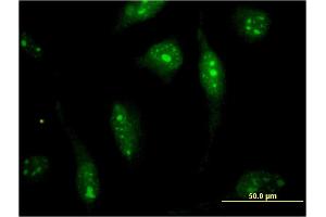 Image no. 2 for anti-Small Optic Lobes Homolog (SOLH) (AA 993-1086) antibody (ABIN1327119)