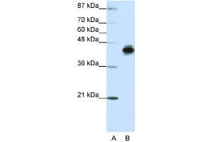 Image no. 1 for anti-Keratin 18 (KRT18) (N-Term) antibody (ABIN2778669)