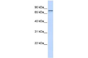 Image no. 2 for anti-ADAM Metallopeptidase Domain 15 (ADAM15) (Middle Region) antibody (ABIN634676)