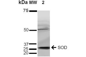 Image no. 3 for anti-Superoxide Dismutase 3, Extracellular (SOD3) (AA 227-236) antibody (Biotin) (ABIN2482054)