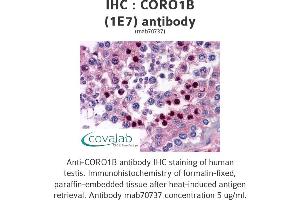 anti-Coronin, Actin Binding Protein, 1B (CORO1B) (AA 1-490), (full length) antibody
