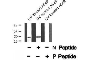 Image no. 1 for anti-Jun Dimerization Protein 2 (JDP2) (pThr148) antibody (ABIN6271718)