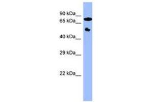 Image no. 1 for anti-Cytochrome P450, Family 11, Subfamily B, Polypeptide 2 (CYP11B2) (C-Term) antibody (ABIN6741746)