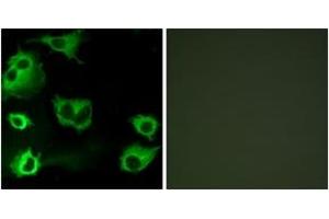 Image no. 2 for anti-Cysteinyl Leukotriene Receptor 1 (CYSLTR1) (AA 131-180) antibody (ABIN1535582)