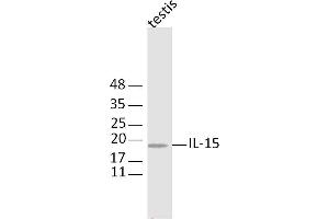 Image no. 1 for anti-Interleukin 11 (IL11) (AA 22-120) antibody (ABIN735023)