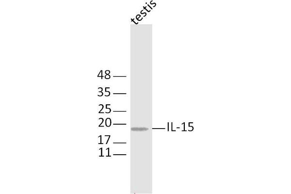 anti-Interleukin 11 (IL11) (AA 22-120) antibody